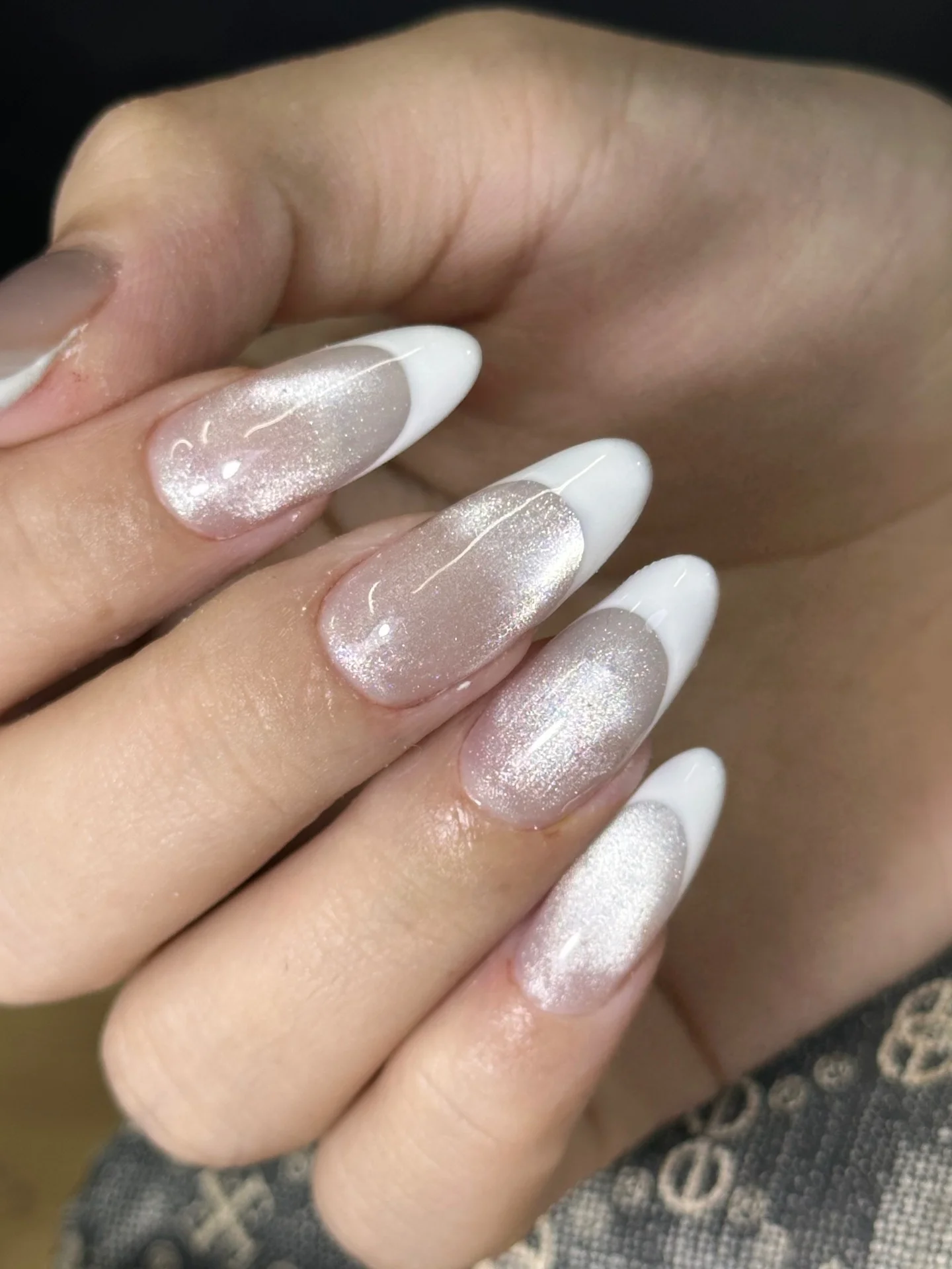 Kỹ thuật đắp overlay và tip
