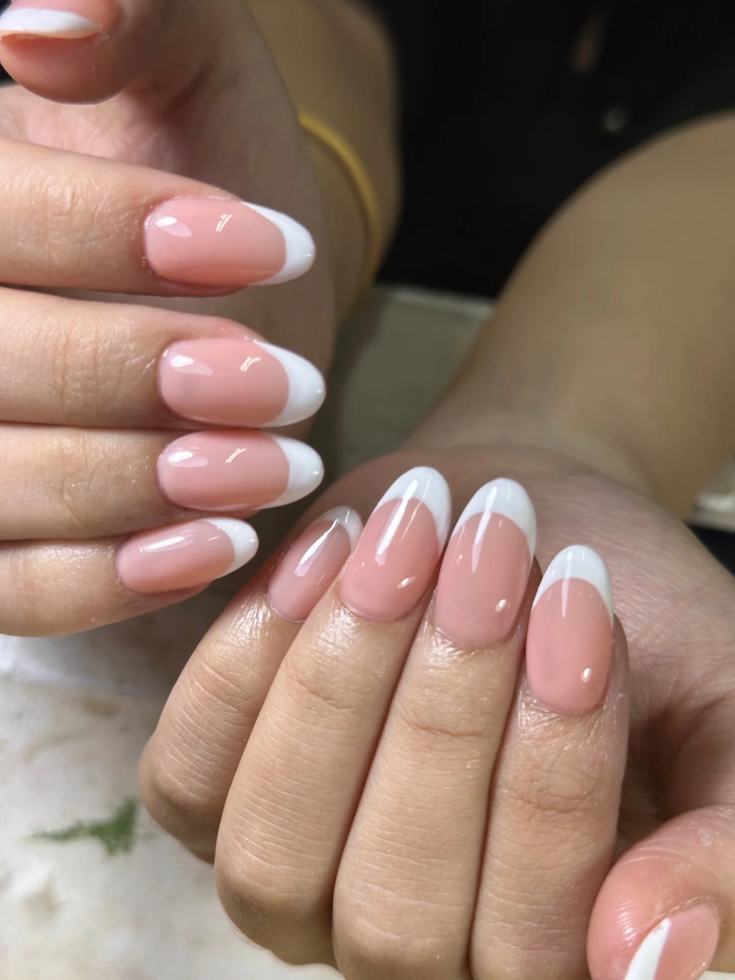 Kỹ thuật Gel X